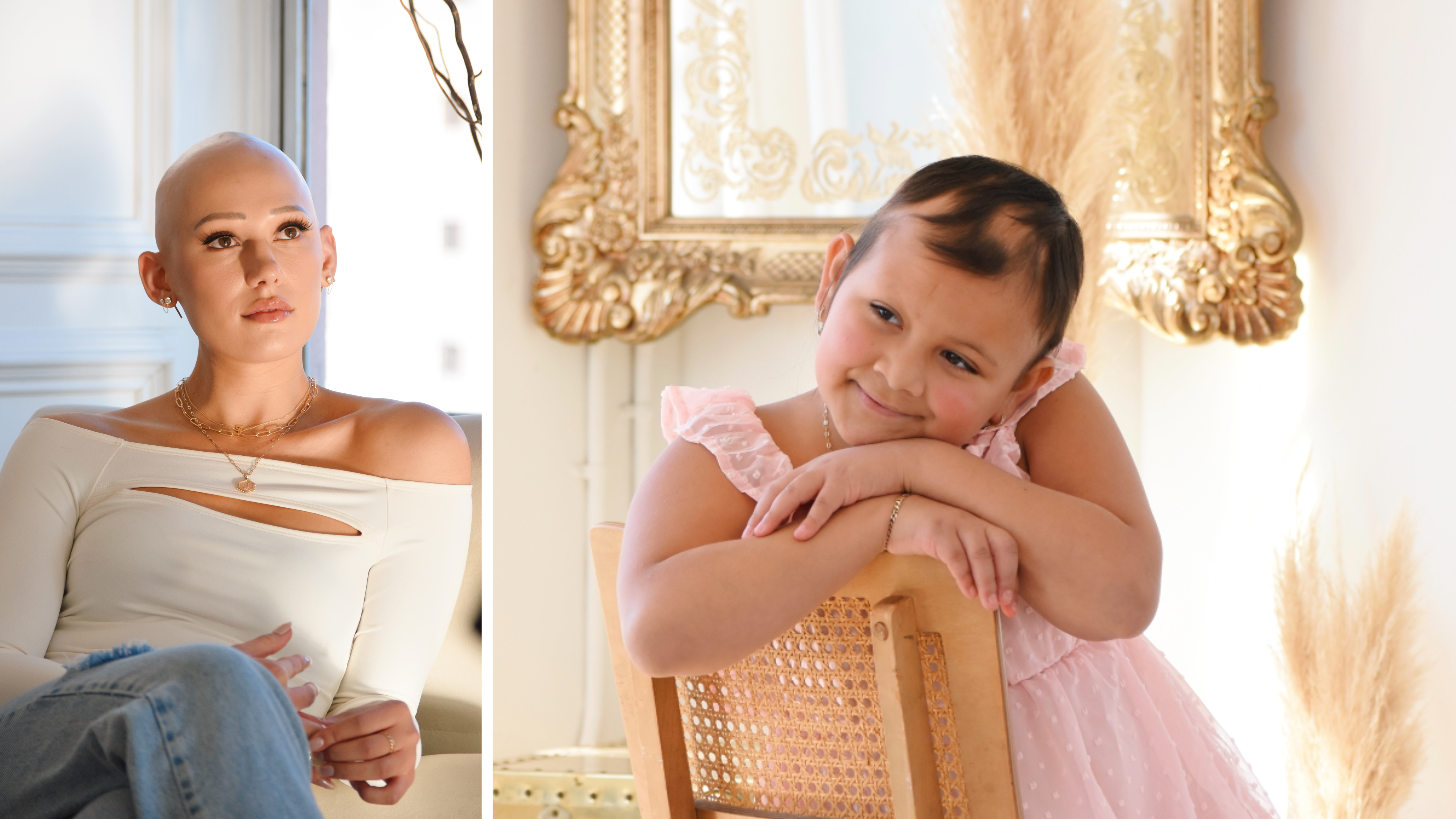 Alopecia: Causes, Awareness & How To Help